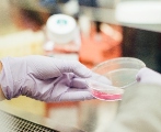 Kidney Cancer